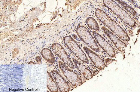 Immunohistochemical analysis of paraffin-embedded human colon tissue. 1, GAPDH Monoclonal Antibody (2B5) was diluted at 1:400 (4°C, overnight). Negative control was used by secondary antibody only.