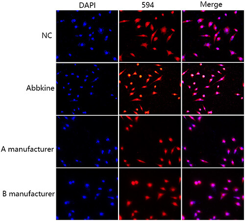 Abbkine SuperKine™ Enhanced Antifade Mounting Medium shows more "dazzling" fluorescence. The second row is the rendering after using Abbkine SuperKine™ Enhanced Antifade Mounting Medium (Cat. No. BMU104-EN), comprehensively comparing the product of brand A and brand B.