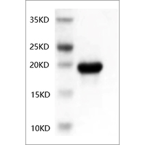 SDS-PAGE analysis of Human IL-6 protein.
