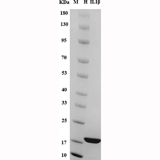 SDS-PAGE analysis of Human IL-1β protein.