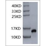SDS-PAGE analysis of Human IL-2 protein.