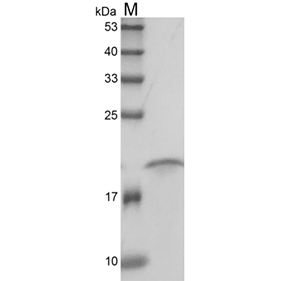 SDS-PAGE analysis of Human sRANKL protein.