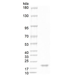 SDS-PAGE analysis of Human BAFF protein.