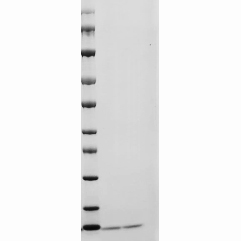 SDS-PAGE analysis of Human IGF1 Protein.