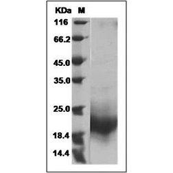 SDS-PAGE analysis of Mouse GM-CSF protein.