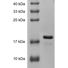 SDS-PAGE analysis of Human TRAIL protein.
