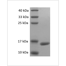 SDS-PAGE analysis of Mouse TNF-alpha protein.