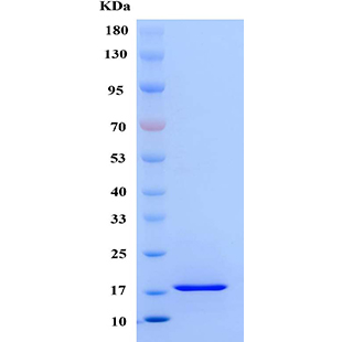 SDS-PAGE analysis of Rat FGF2 protein.