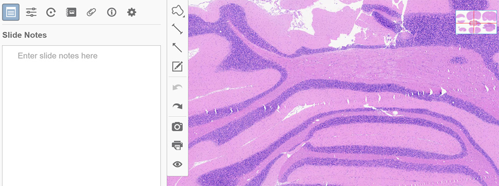 Motic DSServer 的增加附件功能可在數位切片檔內新增附件，如 JPG、TXT、DOC 等格式，整合所有相關資料。