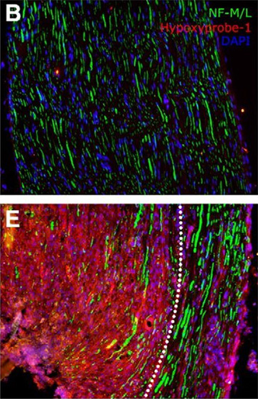 Immunocytochemistry. Lim, Tony KY, et al used FITC Conjugation Kit - Lightning-Link® (ab102884) as part of examining traumatic nerve injury. They used the kit to conjugate FITC to mouse anti-neurofilament 160/200 for use in immunohistochemistry.B, Contralateral nerves were stained for hypoxyprobe-1, DAPI, and neurofilament 160/200 (NF-M/L, axons). E, Ipsilateral nerves were subjected to the same staining. The area in proximity to the injury site is shown. Hypoxia, as shown by hypoxyprobe-1 staining, is observed in a region close to the injury site, in which axons, macrophages, and Schwann cells are all found to be hypoxic. This hypoxic region, in which nerve fibers were ligated, is delineated by the white dotted line. Areas outside of the dotted regions containing nonligated nerve fibers still have more hypoxyprobe deposition than contralateral nerves.