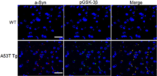 Immunohistochemistry (PFA perfusion fixed frozen sections). Wills, Jonathan, et al used FITC Conjugation Kit - Lightning-Link® (ab102884) as part of examining the aggregation and co-localization of α-Syn with pGSK-3β and p-Tau in the striatum of A53T α-Syn mutant mice (A53T Tg) and wild-type mice (WT). They used the kit to conjugate FITC to Anti-p-GSK-3β (pY216) antibody for use in immunohistochemistry (PFA perfusion fixed frozen sections). Right panels constitute merged image of left panels. Sections of striatum of A53T Tg and age-matched WT mice were stained with anti-α-Syn antibody conjugated to Texas Red (red) and anti-p-GSK3β conjugated to FITC (green). Nuclei were stained with DAPI (blue).