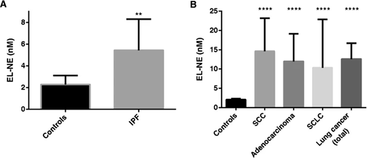 Competitive ELISA. Kristensen JH et al. used ab102890 for the quantification of neutrophil elastase (NE)-degraded elastin (EL). EL-NE fragment levels in serum from patients with IPF (n = 10) compared with controls (n = 9). ** p < 0.01. (B) : EL-NE fragment levels in serum from patients diagnosed with lung cancer (n = 40 in total), SCC (n = 16), adenocarcinoma (n = 16) and SCLC (n = 8) compared with controls (n = 12). **** p < 0.0001. Groups were compared by T-test with Welch correction. Data are shown as the geometric mean (95% CI). Abbreviations : IPF, idiopathic pulmonary fibrosis; SCC, squamous cell carcinoma; SCLC, small cell lung carcinoma.