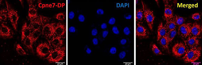 Immunocytochemistry. Lee, Yoon Seon, et al used Cy5® Conjugation Kit (Fast) - Lightning-Link® (ab188288) as part of examining the translocation and localization of newly developed peptide derived from CPNE7 (Cpne7-DP) . They used the kit to conjugate Cy5® to Cpne7-DP oligopeptide for use in immunocytochemistry. The intracellular distribution of Cpne7-DP is shown after odontoblastic MDPC-23 cells were treated with Cy5-labeled Cpne7-DP (10 μg/mL).