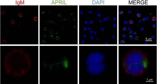 Fluorescence Microscopy. Soleto, Irene, et al used Biotinylation Kit / Biotin Conjugation Kit (Fast, Type A) - Lightning-Link® (ab201795) as part of examining the effect of APRIL on B cells using rainbow trout (Oncorhynchus mykiss) as a model species. They used the kit to conjugate biotin to a recombinant trout proliferation-inducing ligand (APRIL) for use in Fluorescence microscopy. Total leukocytes from spleen were incubated with recombinant biotinylated APRIL (1 μg/ml) for 15 min, then plated onto poly-l-lysine-coated glass slides, fixed and labeled with anti-IgM (shown as red) and FITC-streptavidin (APRIL, shown as green), then counterstained with DAPI (blue), and analyzed by confocal fluorescence microscopy.