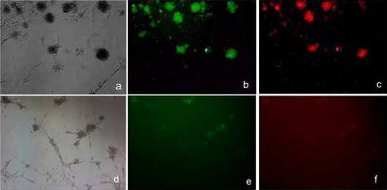 Fluorescence Microscopy. Haque, Nasreen S., Akaash Tuteja, and Niloufar Haque used APC Conjugation Kit - Lightning-Link® (ab201807) as part of examining as part of examining embryoid body formation. They used the kit to conjugate APC to anti-CCR8 antibody for use in immunofluorescence. Anti CCL1 inhibits the expression of CCR8 and FoxP3 in mouse mesenchymal stem cells (mMSCs). Untreated (5a,-c) and anti-CCL1 treated (5d,-,f) cells were subjected to immunoflourescence with antibodies against FoxP3 (green;5b and e) or CCR8 (red;5c and f).
