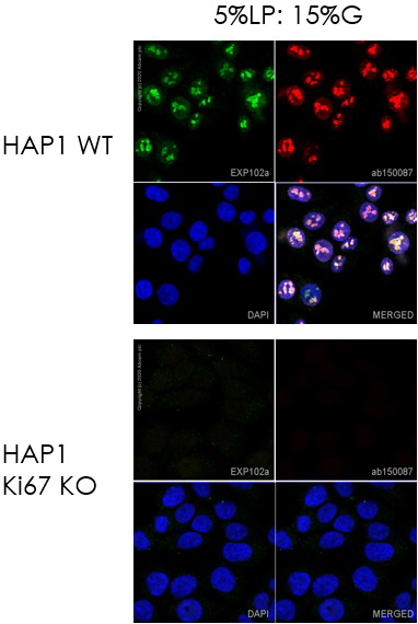 Immunocytochemistry. Direct immunofluorescent staining using Recombinant Anti-Ki67 antibody [EPR3610] - BSA and Azide free (ab209897) labelled with Alexa Fluor® 488 Conjugation Kit (Fast) - Lightning-Link® (ab236553). Lightning-Link® Alexa Fluor® 488 Anti-Ki67 antibody [EPR3610] conjugate was used to stain Ki67-wild-type HAP1 cells (top panel) and Ki67-knock-out HAP1 cells (bottom panel). The cells were fixed with 4% paraformaldehyde (10 min), permeabilized with 0.1% Triton X-100 for 5 minutes and blocked with 1% BSA/10% normal goat serum/0.3M glycine in 0.1% PBS-Tween for 1h. The cells were incubated with 1 μg/ml of LL-Anti-Ki67 Alexa Fluor® 488 (shown in green) or ab209897 (Anti-Ki67 antibody, unlabelled control) overnight at +4°C. ab209897 treated cells only were incubated with ab150087 at 1/1000 dilution for 1 hour at room temperature (shown in red). Nuclear DNA was labelled in blue with DAPI. Image was taken with a confocal microscope (Leica-Microsystems, TCS SP8).