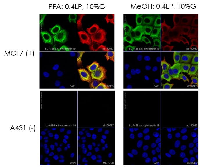 Immunocytochemistry. Direct immunofluorescent staining using Recombinant Anti-Cytokeratin 19 antibody [EP1580Y] - BSA and Azide free (ab195872) labelled with Alexa Fluor® 488 Conjugation Kit (Fast) - Lightning-Link® (ab236553). Lightning-Link® Alexa Fluor® 488 Anti-Cytokeratin 19 [EP1580Y] conjugate was used to stain wild-type MCF7 cells (top panel) and A431 negative cells (bottom panel). The cells were fixed with 4% paraformaldehyde (10 min) or 100% methanol at -20°C (5min), permeabilized with 0.1% Triton X-100 for 5 minutes and blocked with 1% BSA/10% normal goat serum/0.3M glycine in 0.1% PBS-Tween for 1h. The cells were incubated with 1 μg/ml of LL-Anti-Cytokeratin 19 Alexa Fluor® 488 (shown in green) or ab195872 (Anti-Cytokeratin 19 antibody, unlabelled control) overnight at +4°C. ab195872 treated cells only were incubated with ab150087 at 1/1000 dilution for 1 hour at room temperature (shown in red). Nuclear DNA was labelled in blue with DAPI. Image was taken with a confocal microscope (Leica-Microsystems, TCS SP8).