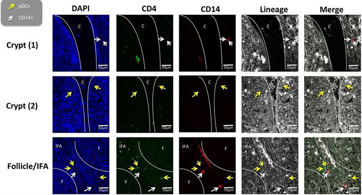 Immunohistochemistry (Frozen sections). Soldevila, Ferran et al used Alexa Fluor® 488 Conjugation Kit - Lightning-Link® (ab236553) as part of examining myeloid cells in the porcine palatine tonsil. They used the kit to conjugate Alexa Fluor® 488 to anti-pig CD4α antibody for use in confocal microscopy. In situ localization of the CD14+ cells and plasmocytoid dendritic cells in porcine palatine tonsil. CD14+ cells and pDCs were localized by confocal microscopy following ethanol fixation of tonsil slices. The areas assessed included the follicle (F), the interfollicular region (IFA), the crypt (C). The tissue was stained using panel 1 antibodies; white arrow CD14+ cells and yellow arrow pDCs. Images are representative of at least two images from each section, from three different pigs. Objective used : (A) 63× oil immersion. Scale bars as shown.