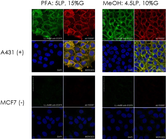 Immunocytochemistry. Direct immunofluorescent staining using Recombinant Anti-EGFR antibody [E235] - BSA and Azide free (ab227459) labelled with Alexa Fluor® 488 Conjugation Kit (Fast) - Lightning-Link® (ab236553). Lightning-Link® Alexa Fluor® 488 Anti-EGFR antibody [E235] conjugate was used to stain wild-type A431 cells (top panel) and MCF7 negative cells (bottom panel). The cells were fixed with 4% paraformaldehyde (10 min) or 100% methanol at -20°C (5min), permeabilized with 0.1% Triton X-100 for 5 minutes and blocked with 1% BSA/10% normal goat serum/0.3M glycine in 0.1% PBS-Tween for 1h. The cells were incubated with 1 μg/ml of LL-Anti-EGFR Alexa Fluor® 488 conjugate (shown in green) or ab227459 (Anti-EGFR antibody, unlabelled control) overnight at +4°C. ab227459 treated cells only were incubated with ab150087 at 1/1000 dilution for 1 hour at room temperature (shown in red). Nuclear DNA was labelled in blue with DAPI. Image was taken with a confocal microscope (Leica-Microsystems, TCS SP8).