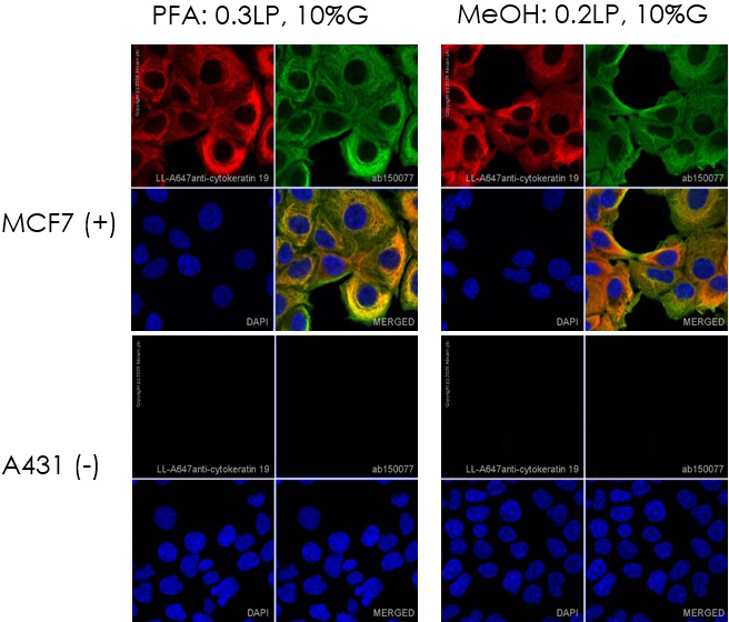 Immunocytochemistry. Direct immunofluorescent staining using Recombinant Anti-Cytokeratin 19 antibody [EP1580Y] - BSA and Azide free (ab195872) labelled with Alexa Fluor® 647 Conjugation Kit (Fast) - Lightning-Link® (ab269823). Lightning-Link® Alexa Fluor® 647 Anti-Cytokeratin 19 [EP1580Y] conjugate was used to stain wild-type MCF7 cells (top panel) and A431 negative cells (bottom panel). The cells were fixed with 4% paraformaldehyde (10 min) or 100% methanol at -20°C (5min), permeabilized with 0.1% Triton X-100 for 5 minutes and blocked with 1% BSA/10% normal goat serum/0.3M glycine in 0.1% PBS-Tween for 1h. The cells were incubated with 1 μg/ml of LL-Anti-Cytokeratin 19 Alexa Fluor® 647 conjugate (shown in red) or ab195872 (Anti-Cytokeratin 19 antibody, unlabelled control) overnight at +4°C. ab195872 treated cells only were incubated with ab150077 at 1/1000 dilution for 1 hour at room temperature (shown in green). Nuclear DNA was labelled in blue with DAPI. Image was taken with a confocal microscope (Leica-Microsystems, TCS SP8).